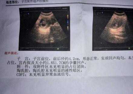 西安代怀孕合法_广州能做供卵试管公立的医院有哪些？附全国排名前十位的试