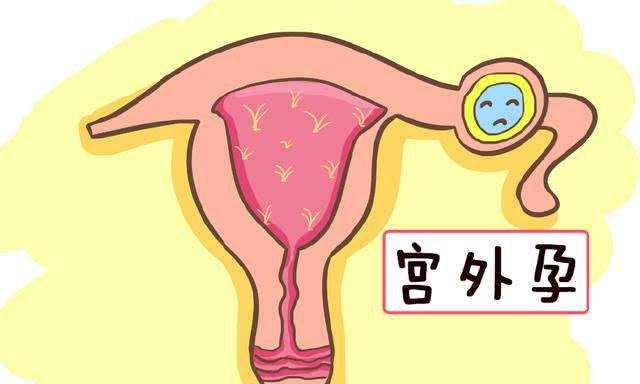 重庆安全的代孕费用 在重庆做一次试管婴儿的费用是多少? ‘孕囊17*19*9看男女